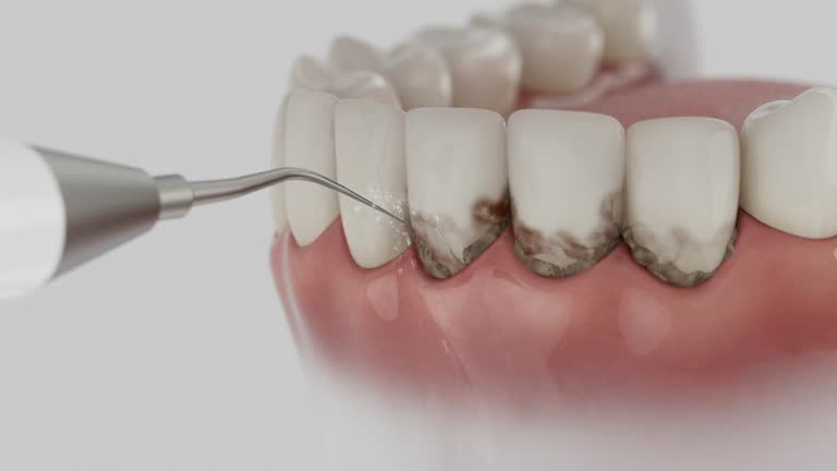 Reliable Emergency Dentist contractor in Second Mesa, AZ by Smile Center Dentistry